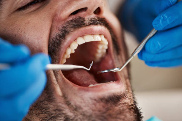 Best Emergency Treatment for Toothache in Lyons, GA