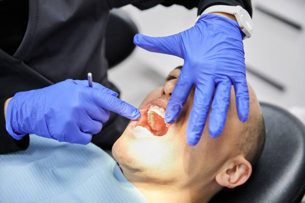 Best Emergency Wisdom Teeth Removal in Lyons, GA